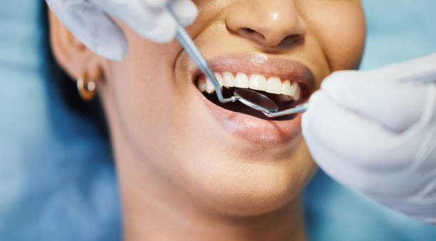 Best Broken or Cracked Tooth Emergency Dentist in Calhoun, GA
