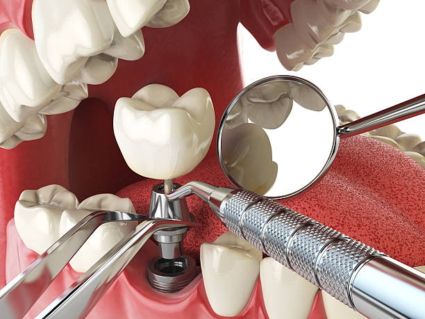 Best Emergency Dentist for Special Needs Patients in Calhoun, GA
