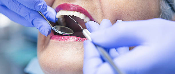 Best Weekend Emergency Dentist in Calhoun, GA